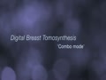 3D Mammography Breast Tomosynthesis Exam - Scottsdale Medical Imaging 